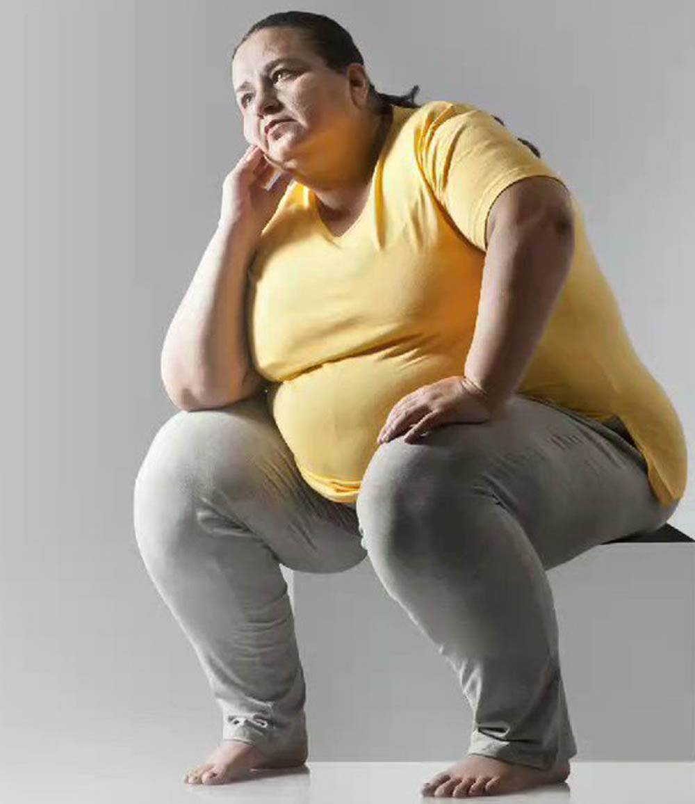 Chirurgie bariatrique pour personnes atteintes d'obésité
